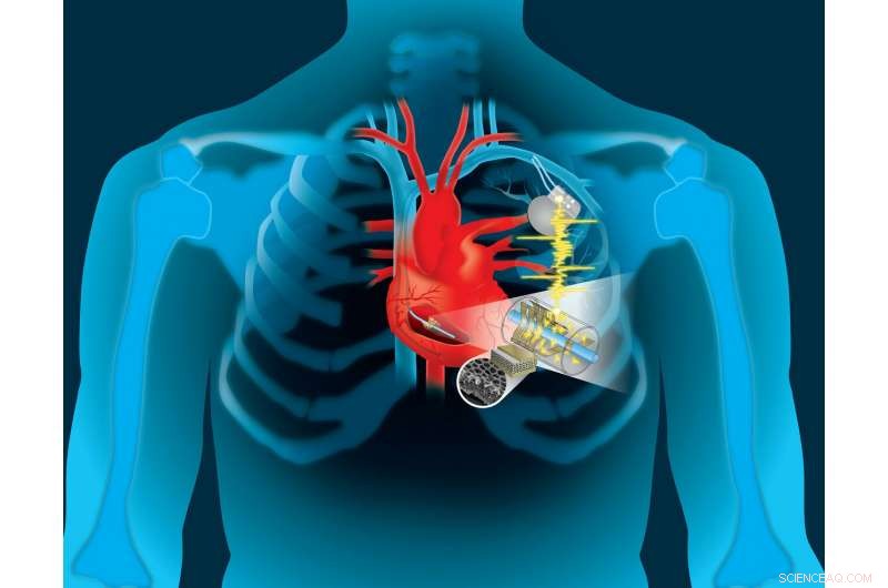 Engineers Capture Heart Energy to Power Life‑Saving Implantable Devices