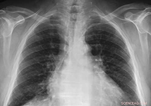 MIMIC Chest X‑Ray Database: Free Access to 350,000+ Patient Radiographs for Researchers