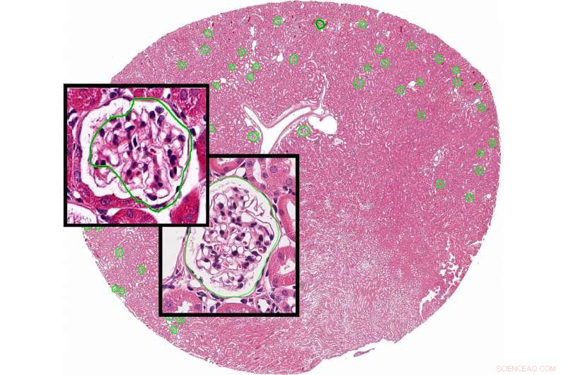 Introducing UB: A Segmentation Tool That Empowers Clinicians to Train AI for Accurate Medical Image Annotation