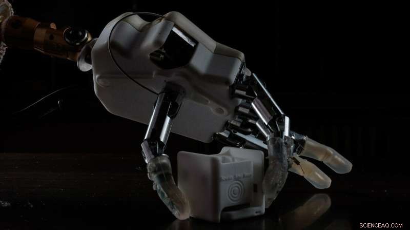 New Bionic Hand Restores Proprioception for Amputees