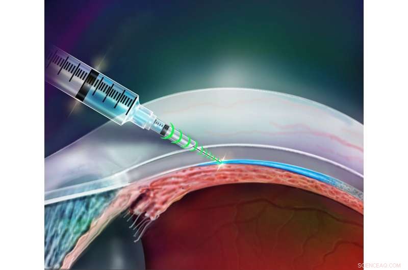 Smart Needle Uses Resistance Sensing to Precisely Target Drug Delivery