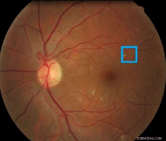 Leveraging Minimal Data for Accurate Disease Recognition