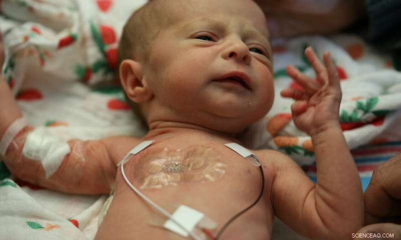 Wireless Sensors Transform NICU Baby Monitoring