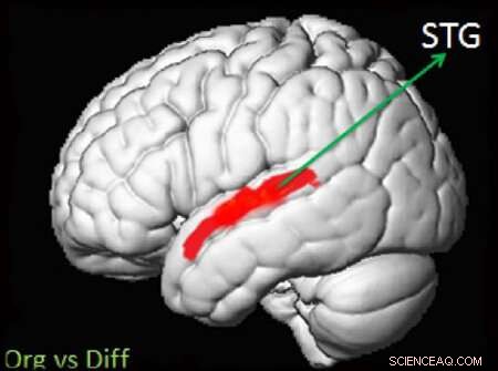 Are Human Brains Susceptible to Voice Morphing Attacks? Insights from UAB Research