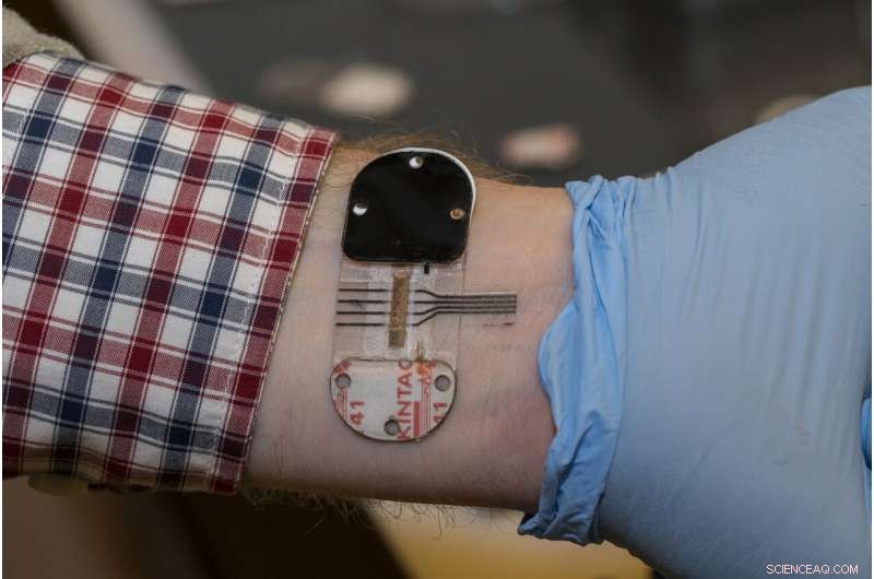 Sweat-Based Sensors Offer Promising Noninvasive Health Monitoring