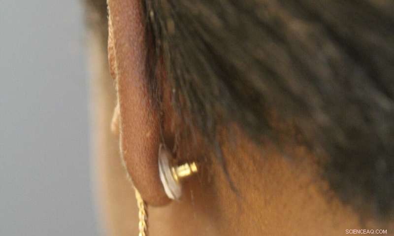 Innovative Contraceptive Jewelry: A New Approach to Family Planning