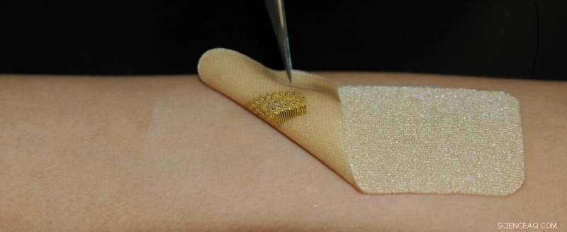 Skin‑Like Wearable Sensors Accelerate Wound Healing