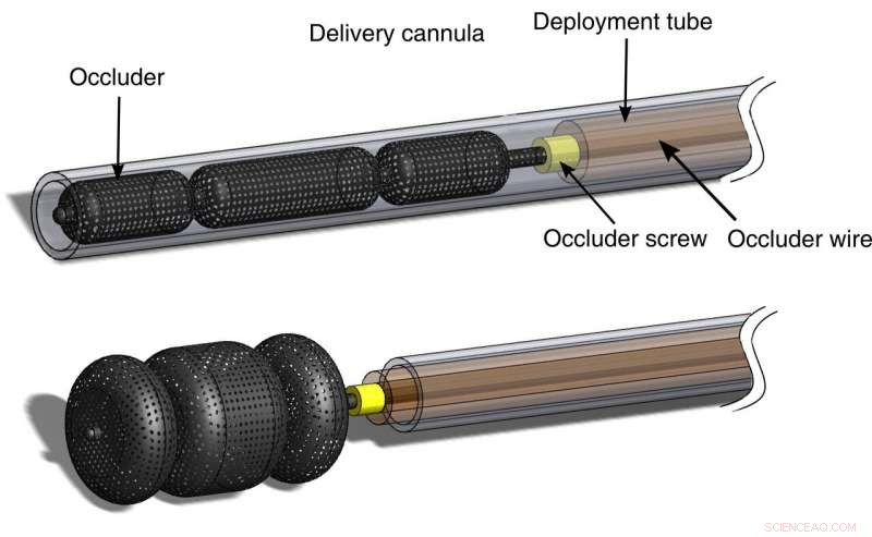 Pioneering Autonomous Navigation Inside the Body: A Breakthrough in Medical Robotics