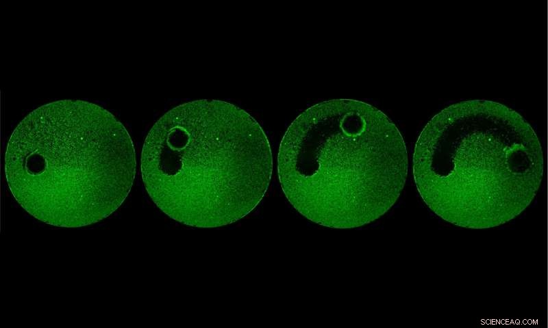 Microrobots Offer a Precise Solution for Dental Plaque Removal