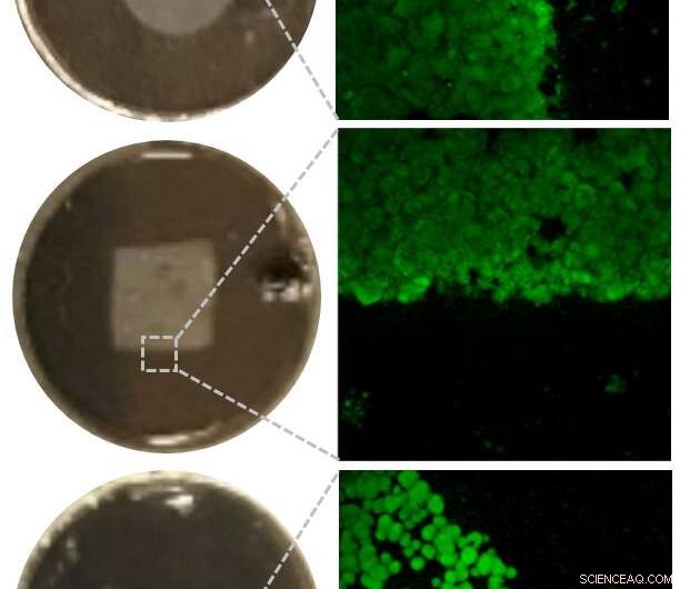 Microrobots Offer a Precise Solution for Dental Plaque Removal