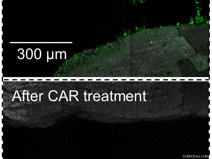 Microrobots Offer a Precise Solution for Dental Plaque Removal