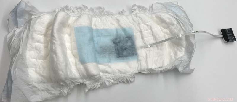 Innovative Diaper Sensors Detect UTIs Early, Preventing Severe Complications