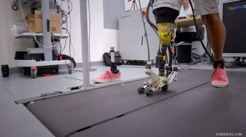 Revolutionary Prosthetic Foot Enhances Stability on Challenging Terrain