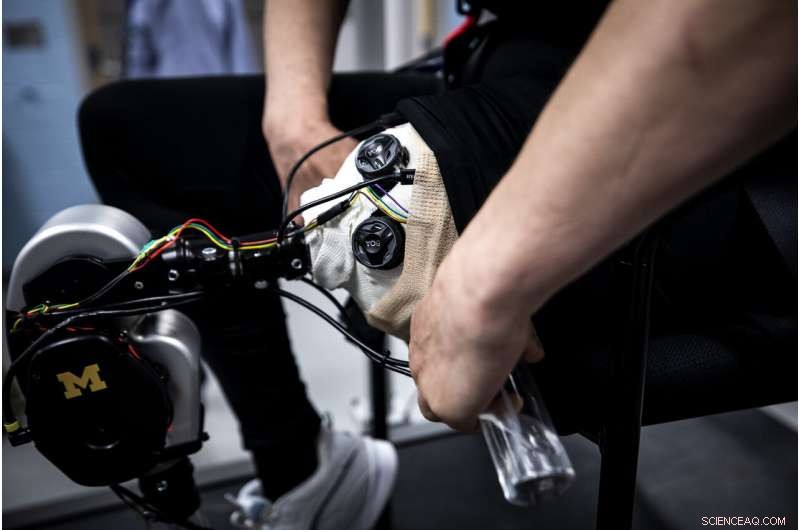 Revolutionary AI-Driven Prosthetic Platform Accelerates Breakthroughs in Limb Replacement