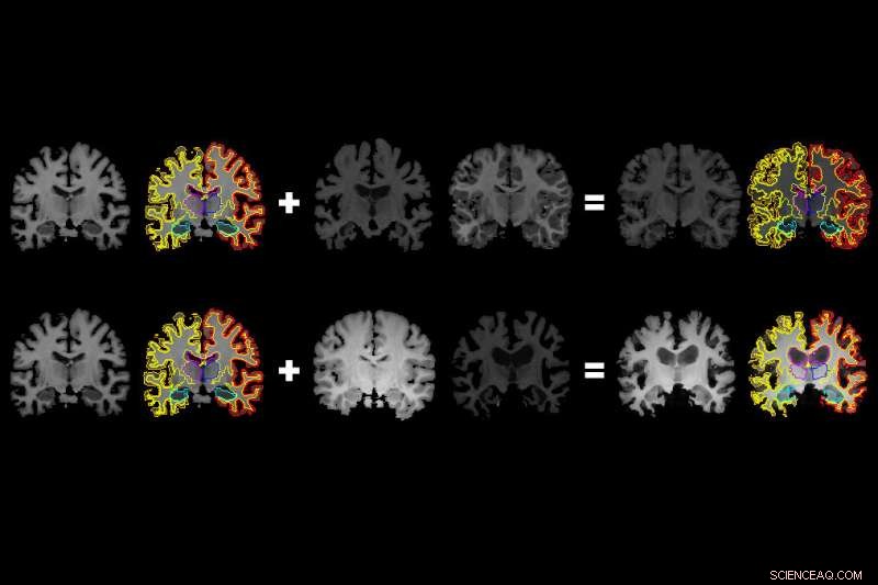 Single Brain Scan Generates Rich AI Training Data for Neurological Diagnosis