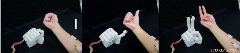 3D‑Printed Prosthetic Hand Learns to Predict Rock‑Paper‑Scissors Moves