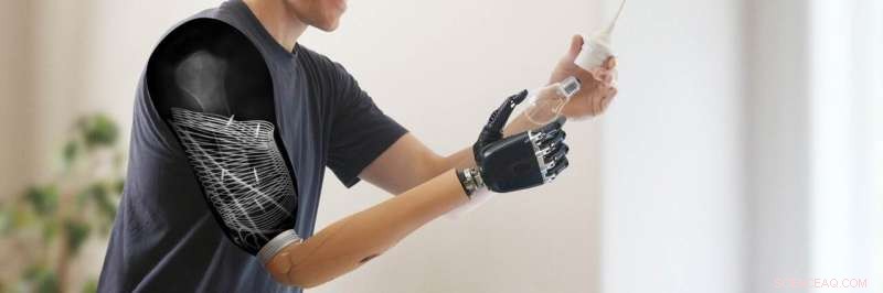 Innovative Implantable Sensors Enable Wireless Muscle Signal Control After Nerve Transfer Surgery