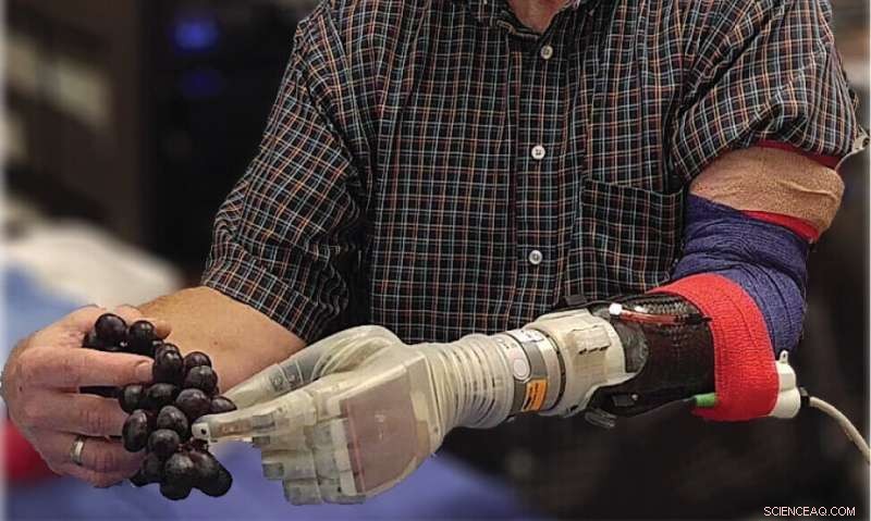 Thought-Activated Prosthetic Arm with Touch Sensation: A Breakthrough for Amputees