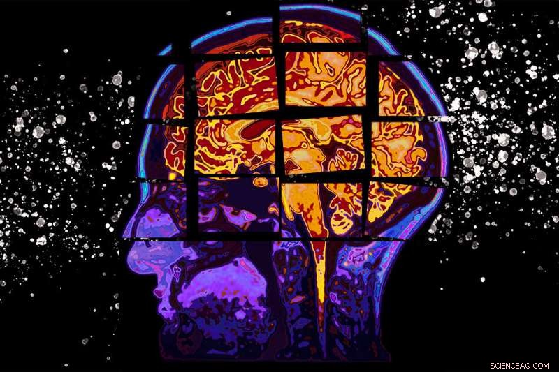 MIT Model Forecasts Alzheimer’s Cognitive Decline Up to Two Years Ahead