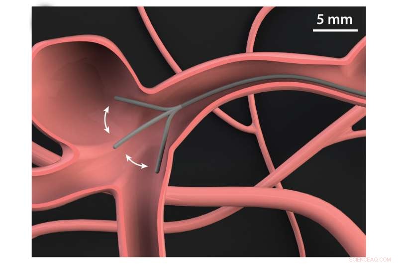 Magnetically Steerable Robotic Thread Navigates Brain Blood Vessels