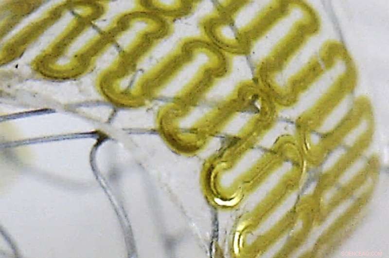 Innovative Stretchable Wireless Sensor Enables Continuous Monitoring of Cerebral Aneurysm Healing