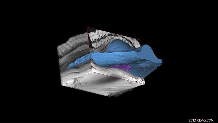 New Implanted Device Breakthrough: Advancing Soft Tissue Immune Response Management