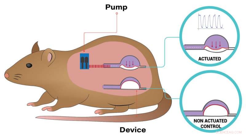 New Implanted Device Breakthrough: Advancing Soft Tissue Immune Response Management