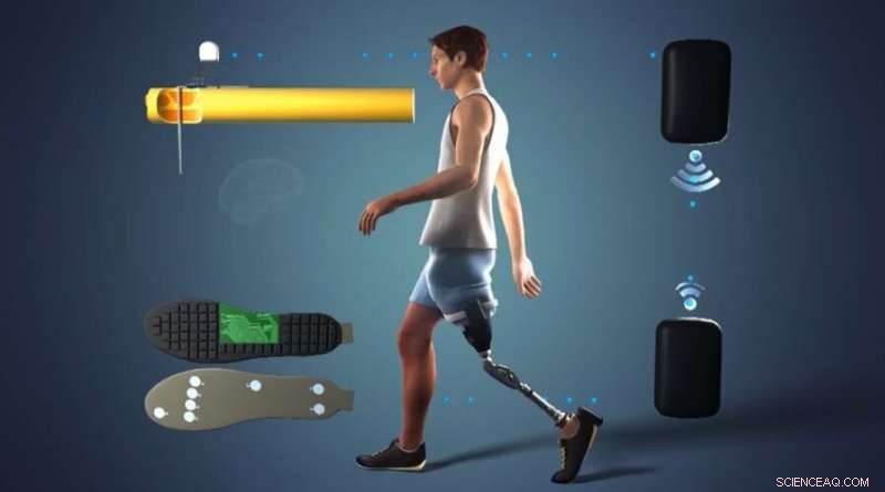 New Prosthetic Leg with Sensory Feedback Boosts Mobility for Above-Knee Amputees