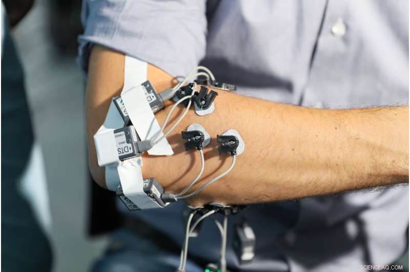 EPFL s Intelligent Prosthetic Hand Combines Human Input with Autonomous Control