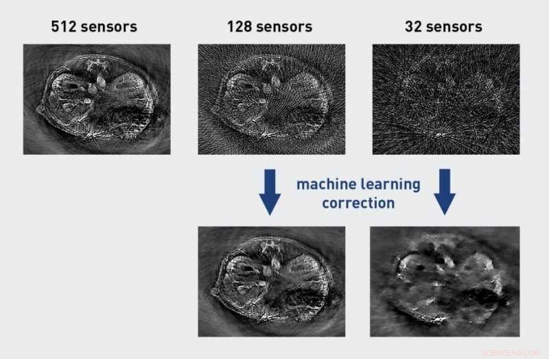 AI Enhances Precision in Biomedical Imaging