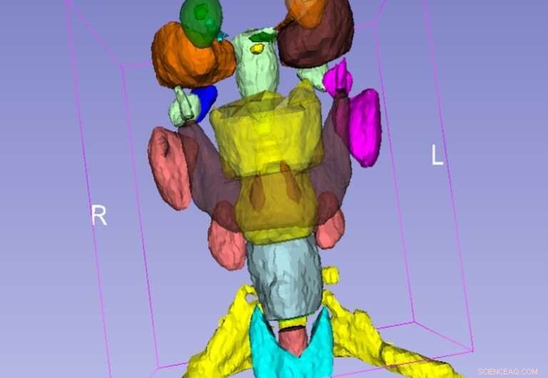 New Deep‑Learning Tool Detects Vulnerable Anatomy in CT Scans to Enhance Radiation Therapy Safety