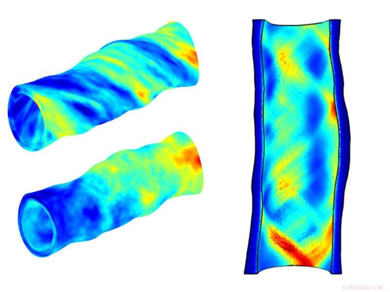 Managing Variability in Patient‑Specific Vascular Models