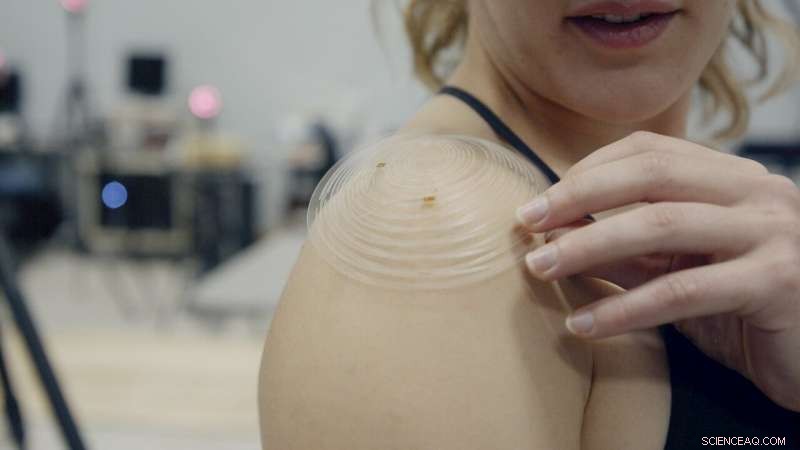 Kirigami‑Enabled Shoulder Patch Enhances Injury Recovery & Athletic Training