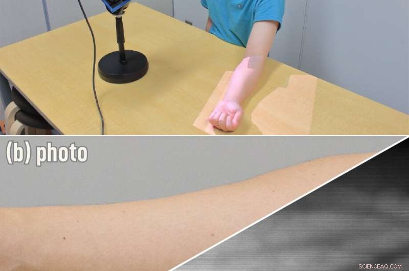 Exploring Internal Anatomy Using Indirect Light Imaging