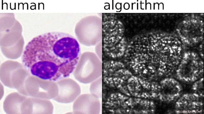 AI-Powered Single-Cell Blood Analysis: Precision Diagnostics