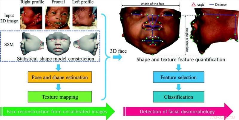 High‑Precision Facial Analysis Identifies Genetic Syndromes with Exceptional Specificity