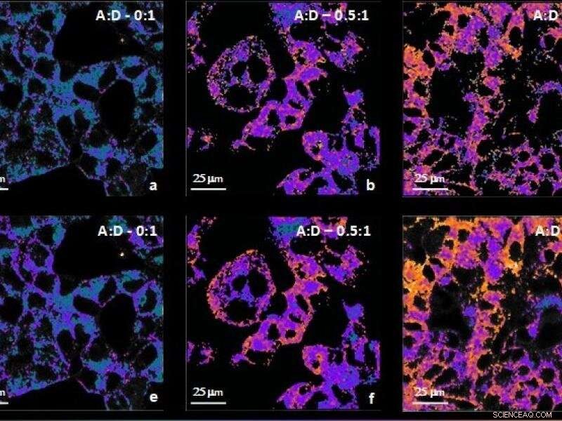 Deep Neural Networks Enhance Cellular Imaging for Improved Disease Diagnosis