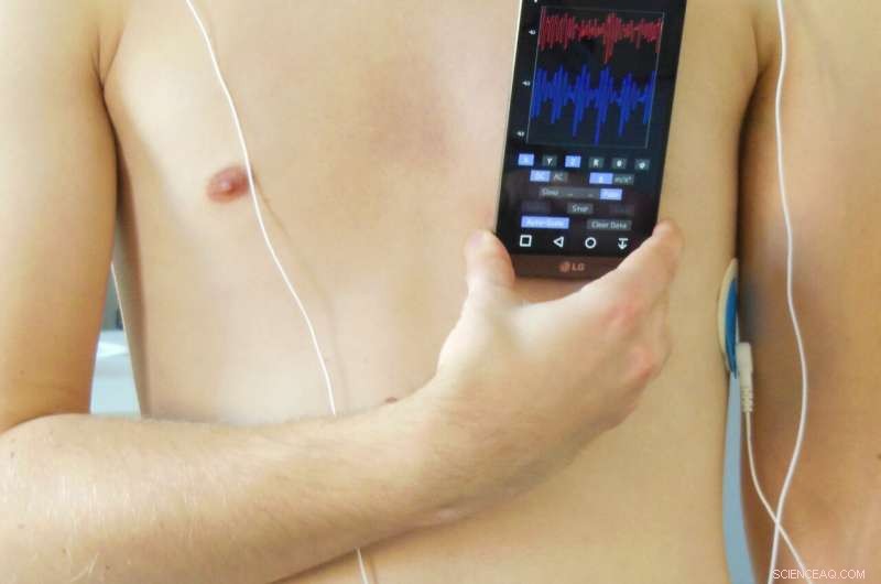 Accurate Stress Detection Using Only Your Smartphone: A Wearable-Free Approach