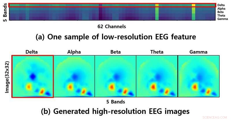 Revolutionizing Emotion Detection: Advanced Deep Learning Model for EEG Signals