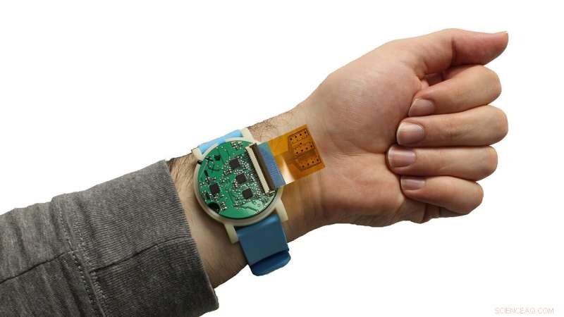 Smartwatch‑Sized Biosensor Monitors Body Chemistry to Elevate Performance and Reduce Injury Risk