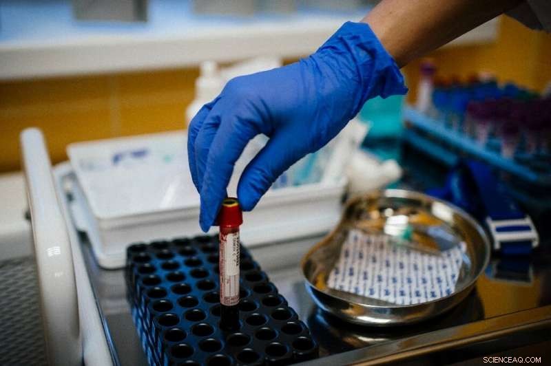 Russia s Biohackers Push Boundaries in Body Modification