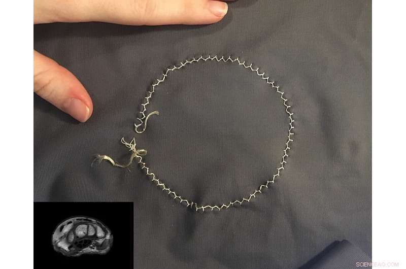 Purdue’s Stretchable Coils Promise Easier, More Comfortable MRI Scans for Patients