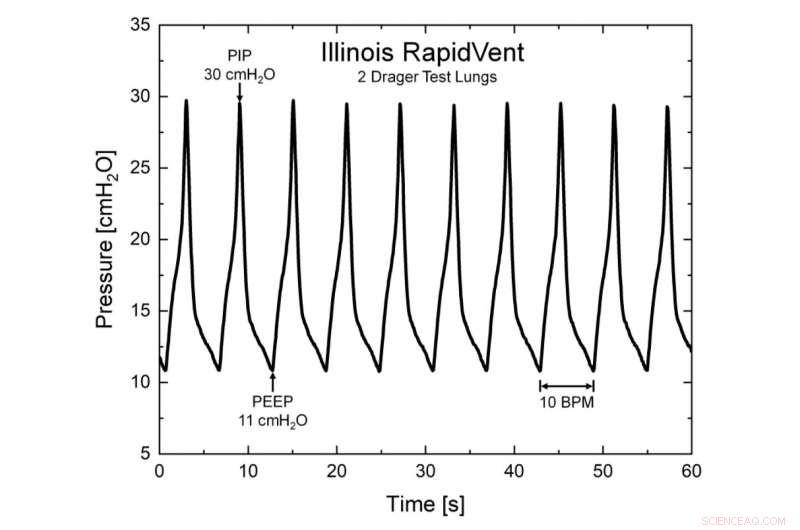 U. Illinois Team Unveils Working Prototype of Emergency Ventilator