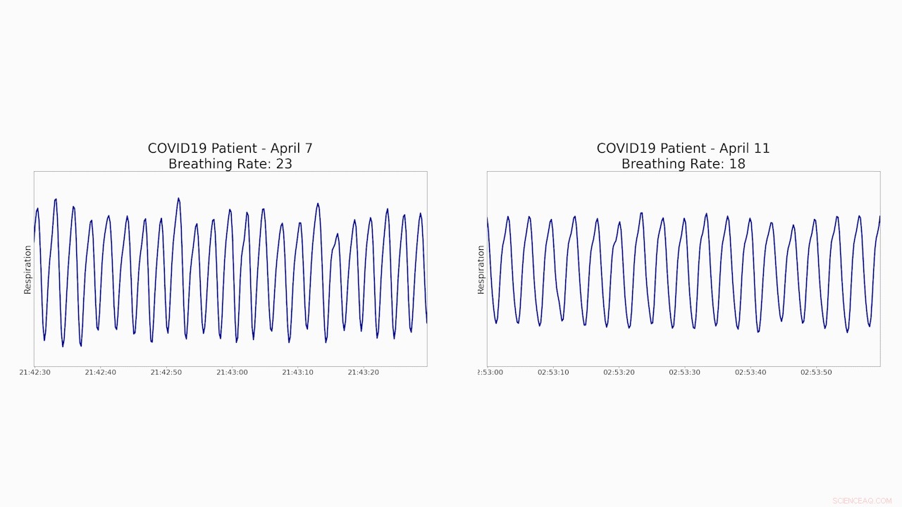 CSAIL s Remote Monitoring Device Enhances COVID-19 Patient Care