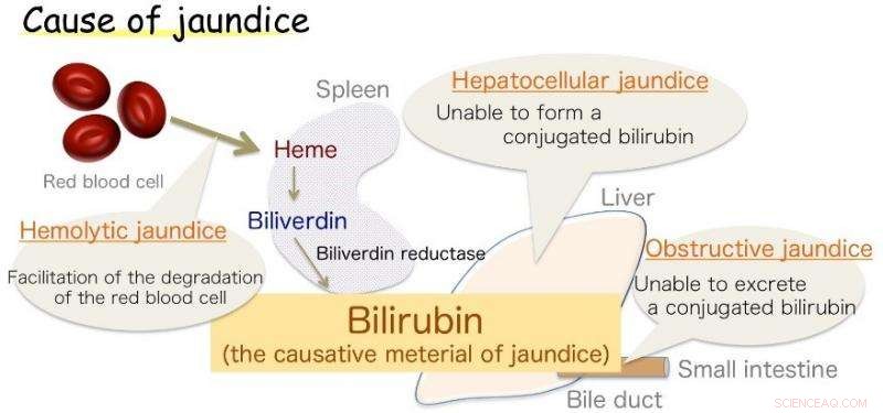 Osaka University Team Breaks New Ground on Biliverdin Reductase, a Key Antioxidant Enzyme in Jaundice