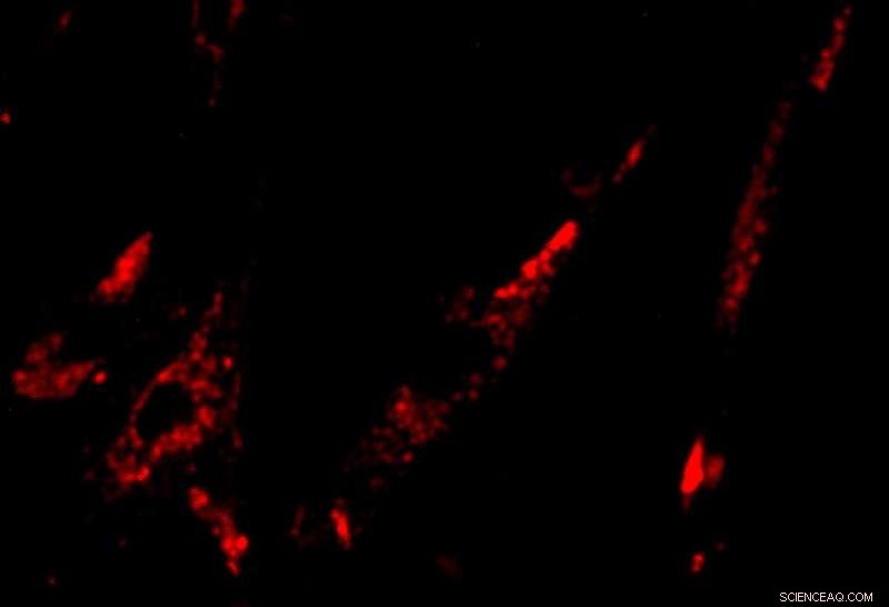 New Fluorescent Probe Illuminates Cancer Cells for Precise Surgery