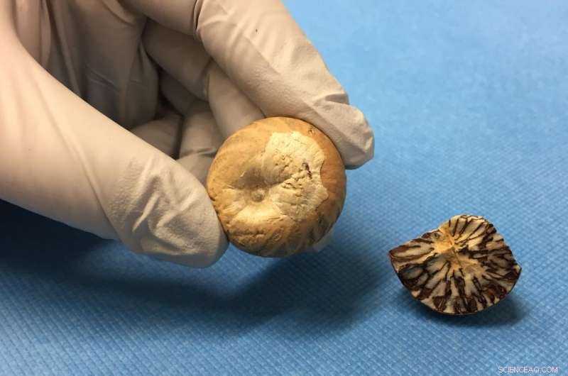 Areca Nut Derivatives Show Promise in Supporting Smokers to Quit Nicotine