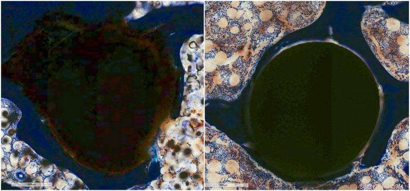 Biodegradable Orthopedic Implant Offers Safe, Superior Bone Support