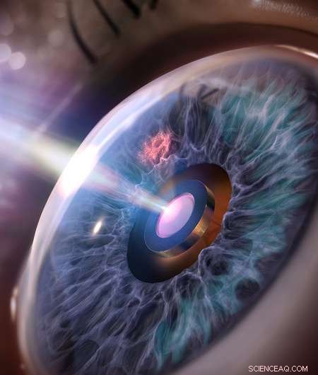 Black Silicon Coating Eliminates Clogging in Eye Implants