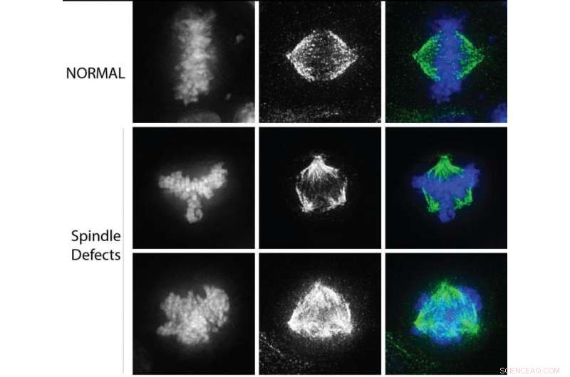 Northwestern Researchers Discover Amino‑Terminal Methylation s Role in Cell Division